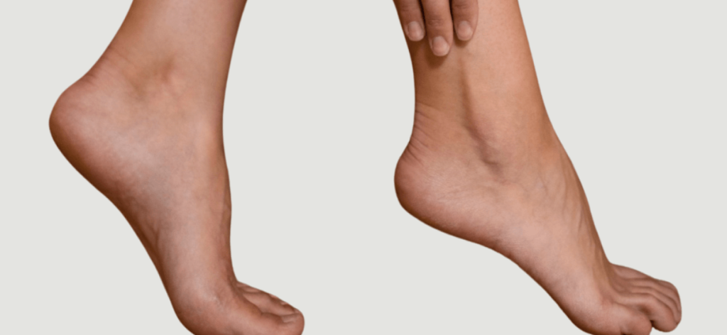 A bokaficam kezelése