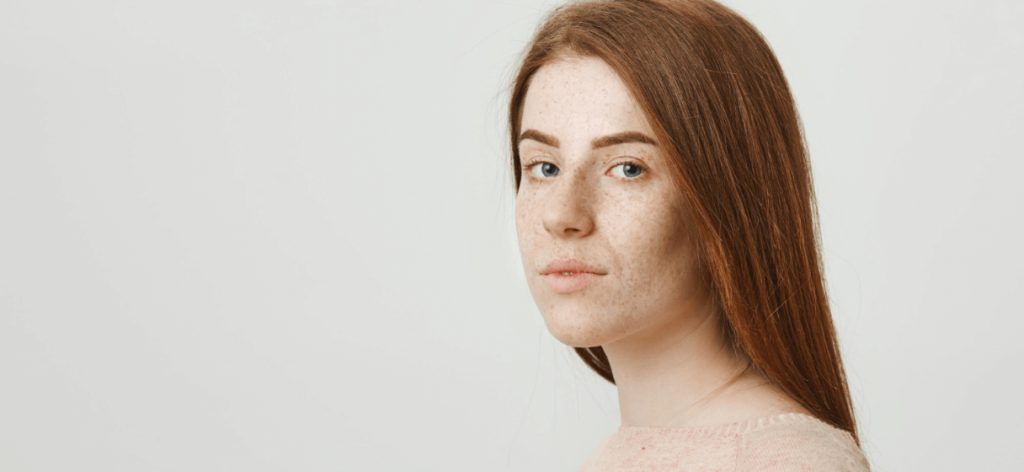 Az akne hegek eltüntetése