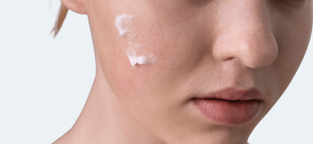 Melyik a legjobb pattanás elleni krém?