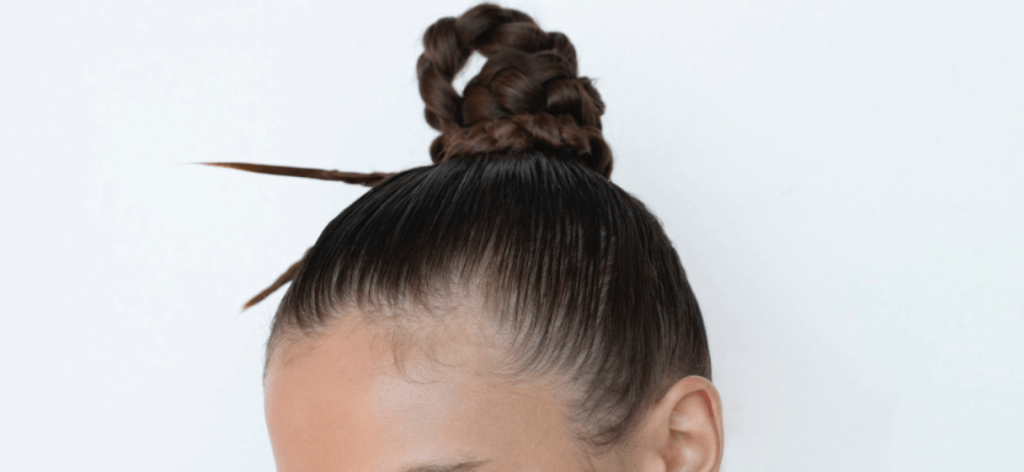 Női kopaszodás homloknál