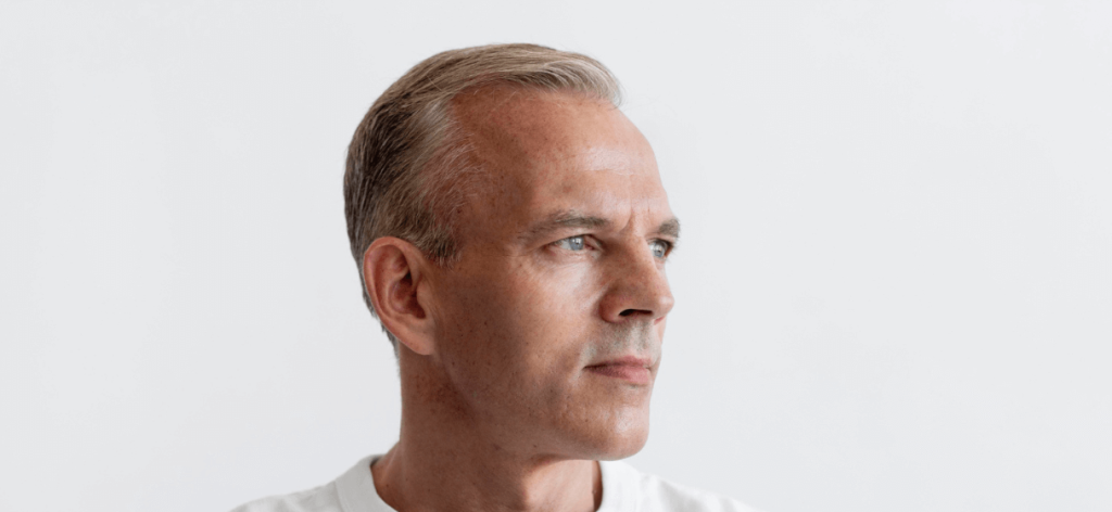 Örökletes hajhullás: fontos időben közbelépni!